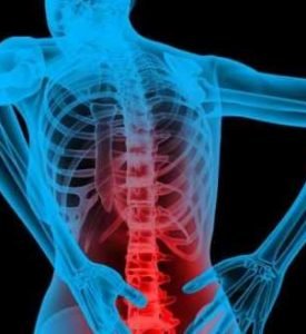 What is back pain? Causes and risk factor to note.